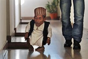 Image result for World Record Smallest Person