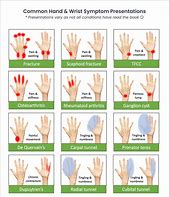 Image result for Hand Uncopyrighted