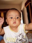 Image result for Familial Macrocephaly
