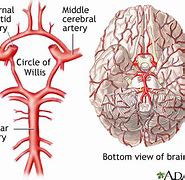 Image result for Circle of Willis in a Patient Standing Up
