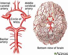 Image result for Internal Carotid Artery Circle of Willis