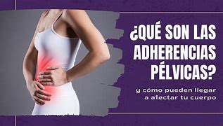 Image result for adgerencia