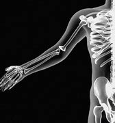 Image result for Skeleton X-Ray