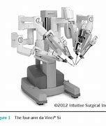 Image result for Surgery Robot Diagram