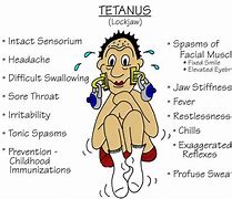 Image result for Tetanus