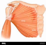Image result for Pectoralis Major Muscle Tear