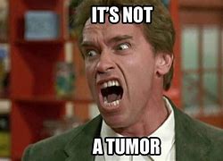 Image result for Arnold Schwarzenegger Tumor Meme
