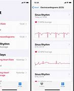 Image result for iPhone ECG App