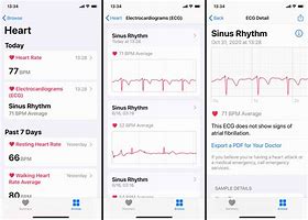 Image result for Apple Watch ECG