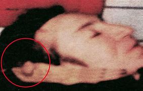 Image result for john lennons autopsy
