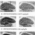 Image result for Acetylcholine Fear Memory CA1
