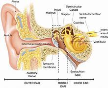 Image result for Ear Canal Papilloma