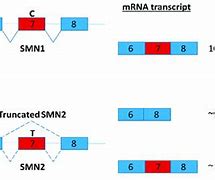 Image result for SMN1 and SMN2