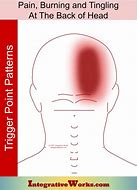 Image result for Sharp Pain Back of Head