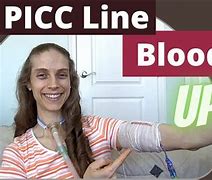Image result for Blood Clot From PICC Line