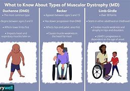 Image result for Duchenne Muscular Dystrophy Genetics