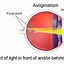 Image result for Astigmatism Headaches