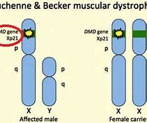 Image result for DMD Chromosome