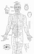 Image result for Acupuncture Healing