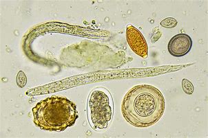 Image result for transgender caption intestinal parasite