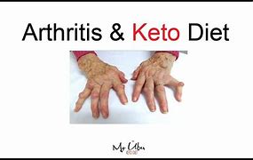 Image result for Arthritis Keto Diet