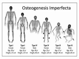 Image result for Body Type Oi
