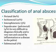 Image result for Types of Abscess
