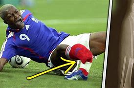 Image result for Bad Football Injuries