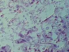 Image result for cryptococcus_neoformans