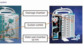 Image result for Atrium Water Seal Chest Drain