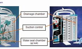 Image result for Dry Suction Chest Tube