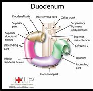 Image result for duodenal