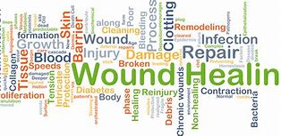 Image result for Wound Healing Clip Art