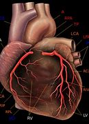 Image result for RCA Heart