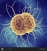 Image result for Nodule of Gonorrhea
