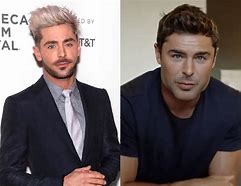 Image result for Zac Efron Broken Jaw