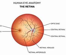 Image result for Retenas Eyes