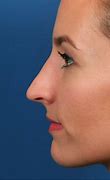 Image result for Sharp Pointed Nose