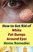 Image result for Bumps On Lip Inside Mouth