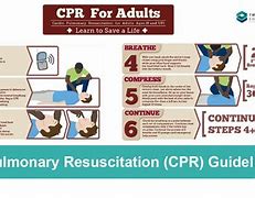 Image result for Recovery CPR Guidelines