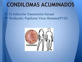 Image result for acuinado