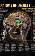 Image result for Anxiety Disorder Brain Scan