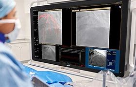 Image result for Philips Hemocalc Screen