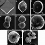 Image result for Precipitated Calcium Carbonate Sem