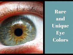 Image result for Rare Human Eye Color Chart