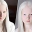Image result for Albino People Girls
