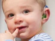 Image result for Pediatric Hearing Aids