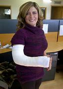 Image result for Long Arm Cast Lac Woman
