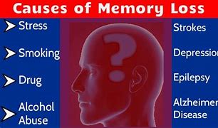 Image result for What Causes Memory Loss