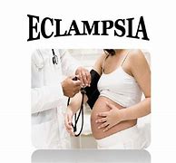 Image result for eclampsia